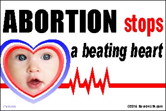 Abortion Stops a Beating Heart 36x54 Vinyl Poster